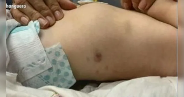 Imagem ilustrativa da notícia Médica chama polícia após perceber hematomas em bebê