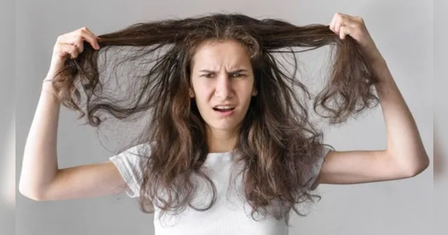 Imagem ilustrativa da notícia Sofre com oleosidade no cabelo? Veja como controlar!