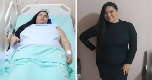 Imagem ilustrativa da notícia Programa de cirurgias bariátricas é retomado no Pará
