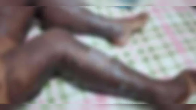 Imagem ilustrativa da notícia Mulher sofre queimaduras graves ao fazer sabão caseiro 