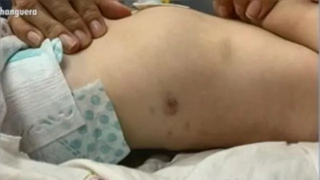 Imagem ilustrativa da notícia Médica chama polícia após perceber hematomas em bebê
