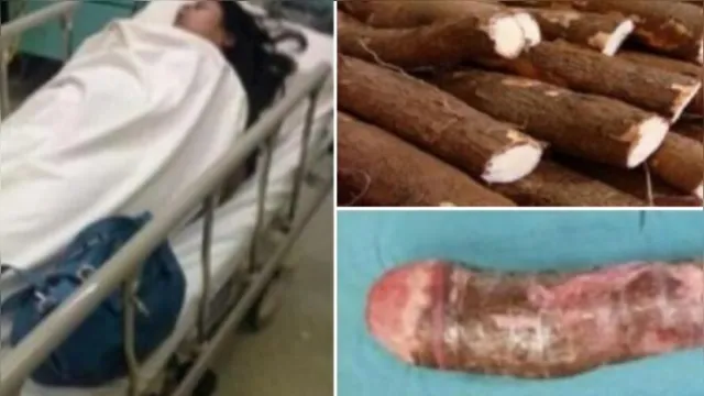 Imagem ilustrativa da notícia Mulher vai parar no hospital após se masturbar com macaxeira