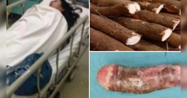Imagem ilustrativa da notícia Mulher vai parar no hospital após se masturbar com macaxeira