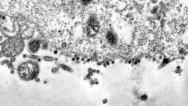 Imagem ilustrativa da notícia Nova variante do coronavírus é detectada na África do Sul
