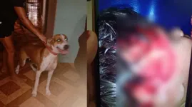 Animal teria fugido e então atacado a criança que mora próximo