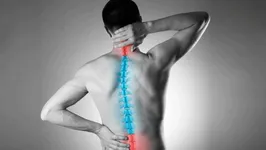 A má postura são um dos principais fatores do desvio de coluna