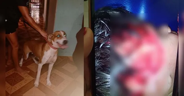 Imagem ilustrativa da notícia Cachorro arranca couro cabeludo de criança no Pará