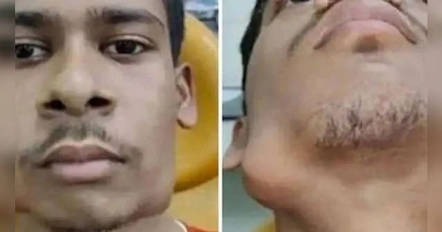 Imagem ilustrativa da notícia Homem que tinha 82 dentes passa por cirurgia; veja o vídeo!