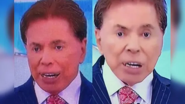 Imagem ilustrativa da notícia Dentista explica mudança nos dentes de Silvio Santos