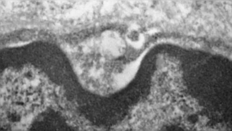 Imagem ilustrativa da notícia Coronavírus se replica em células de glândulas salivares