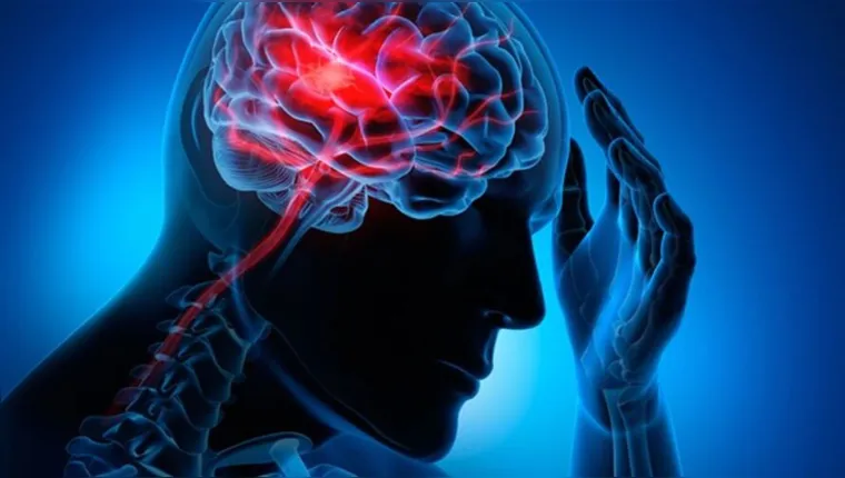 Imagem ilustrativa da notícia Aneurisma cerebral: descubra causas e prevenção 