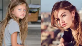 Aos 20 anos, a modelo Thylane Blondeau passou por momentos difíceis em relação a sua saúde. 