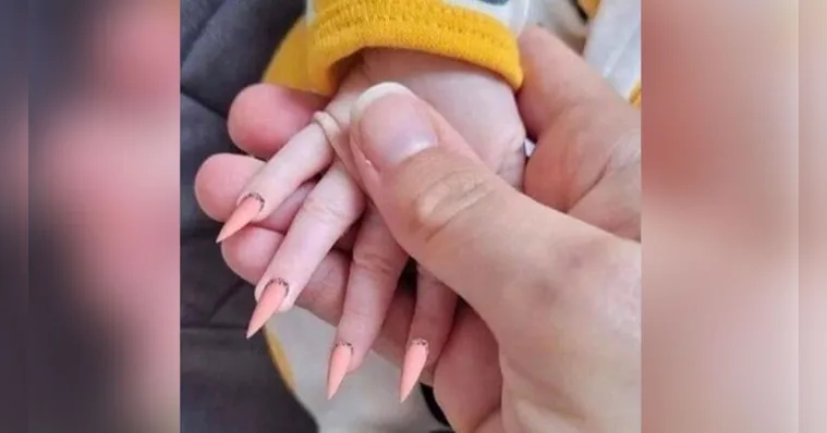 Imagem ilustrativa da notícia Unhas de recém-nascida viralizam na web e levantam polêmica
