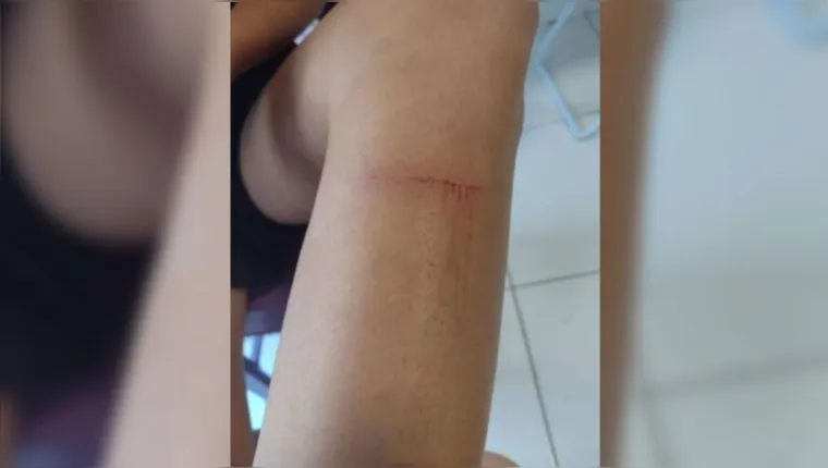 Imagem ilustrativa da notícia Ex-companheiro agride mulher durante 2 horas em Ananindeua