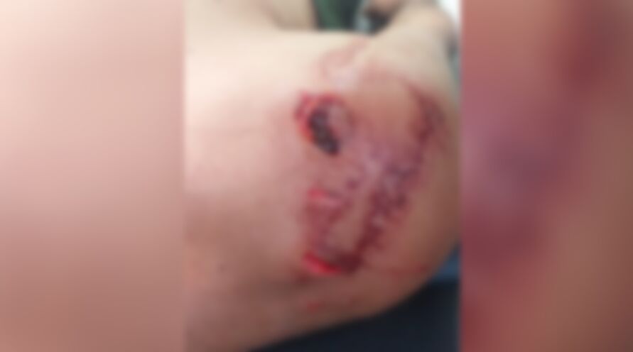 Um homem foi atacado por um jacaré neste último sábado (23) enquanto nadava no Lago do Amor 