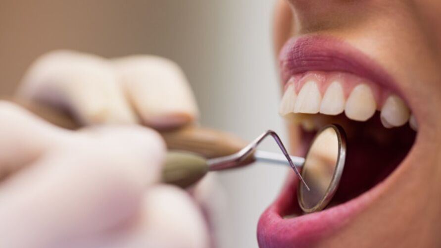 Imagem ilustrativa da notícia Saúde bucal: pequenos hábitos podem evitar graves doenças