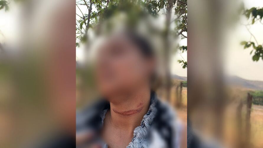A perícia confirmou que a mulher ficou com marcas no pescoço e arranhões nas costas por conta das agressões.