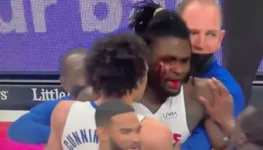 Imagem ilustrativa da notícia Vídeo: LeBron estoura rosto de adversário em briga na NBA