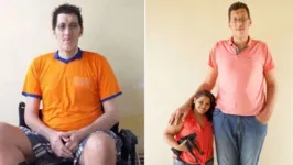 Imagem ilustrativa da notícia Bactéria fará homem mais alto do Brasil amputar perna; saiba