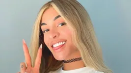 Imagem ilustrativa da notícia Pabllo Vittar preocupa após surgir com rosto deformado; veja