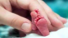 Os bebês são considerados prematuros quando nascem antes da 37ª semana de gestação