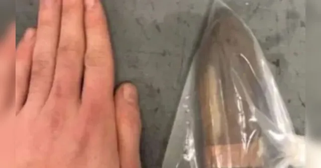 Imagem ilustrativa da notícia Médico chama esquadrão antibomba a paciente com bala no ânus