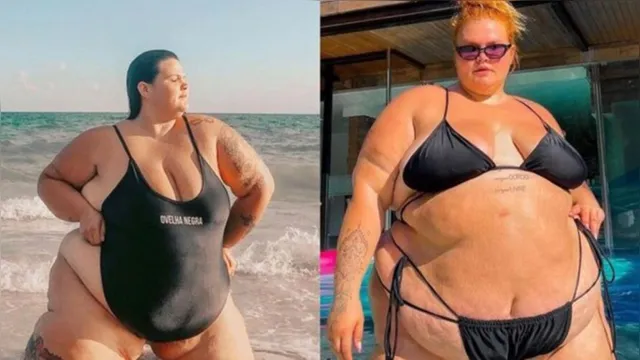 Imagem ilustrativa da notícia Modelo critica gordofobia com fotos de antes e depois