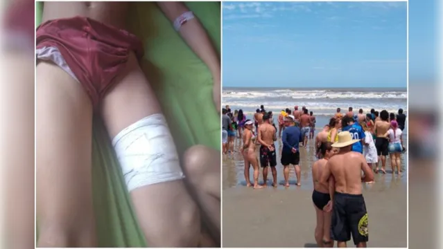 Imagem ilustrativa da notícia Criança de 11 anos é atacada por tubarão em praia de SP