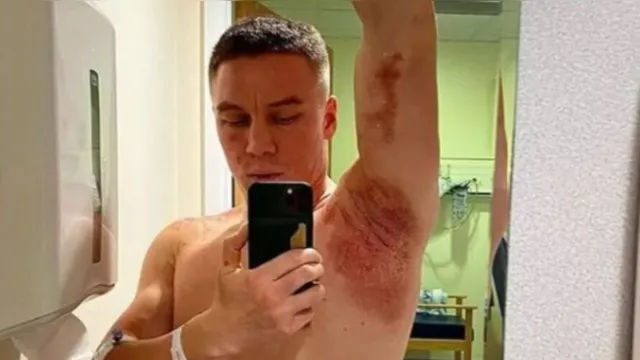 Imagem ilustrativa da notícia Campeão mundial de boxe é atacado com ácido por encapuzados
