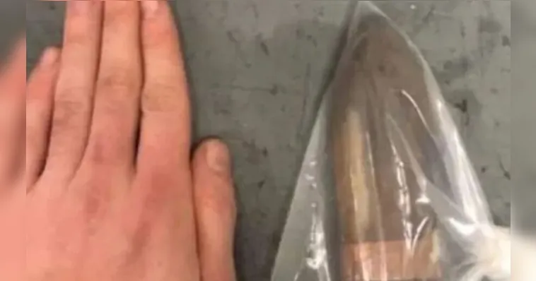 Imagem ilustrativa da notícia Médico chama esquadrão antibomba a paciente com bala no ânus