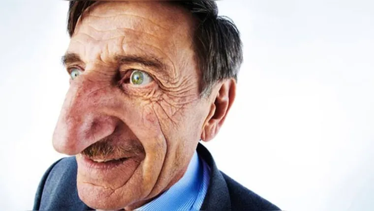 Imagem ilustrativa da notícia Quanto mede o maior nariz do mundo? Veja o recorde mundial
