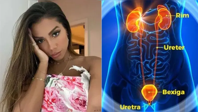 Imagem ilustrativa da notícia Saiba tudo sobre a doença revelada por Anitta após sexo 