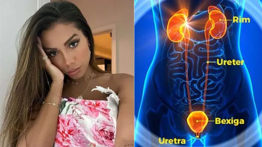 Recentemente, Anitta declarou que sofre de cistite de lua de mel, o que dificulta seu caminhar no dia seguinte após a relação sexual.