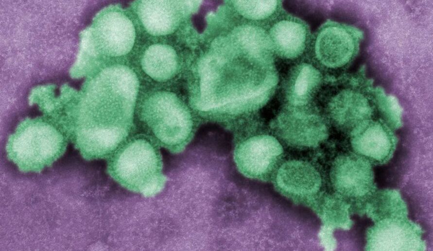 Surto o que se sabe sobre a nova cepa da gripe Influenza? • DOL