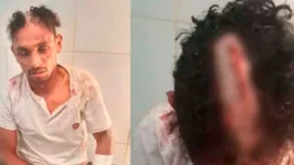 Jhon Lenon Amaral, de 40 anos, foi brutalmente espancado por populares
