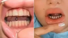 Segundo a dentista, a mulher teve os "dentes assassinados"