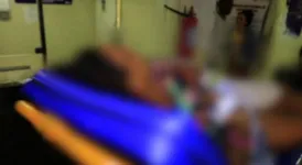 A Jovem teve o corpo queimado pelo companheiro