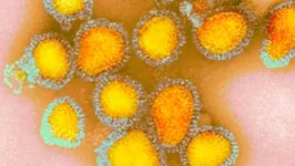 As vacinas para a nova cepa do vírus influenza, denominada H3N2, deverão chegar ao país em março