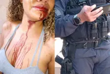 Imagem ilustrativa da notícia Sargento da PM dá soco na boca de mulher em abordagem