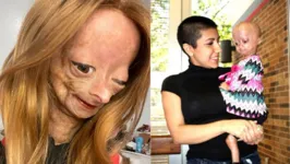 Adalia Rose Williams