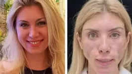 Antes e depois de Yulia Tarasevich
