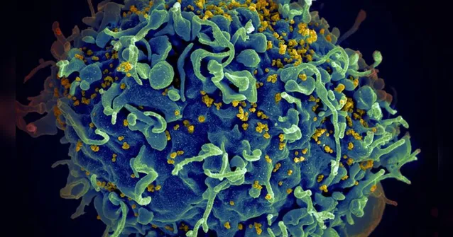 Imagem ilustrativa da notícia Variante mais agressiva do HIV é descoberta na Holanda