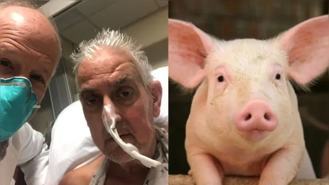 Imagem ilustrativa da notícia Americanos implantam com sucesso coração de porco em humano