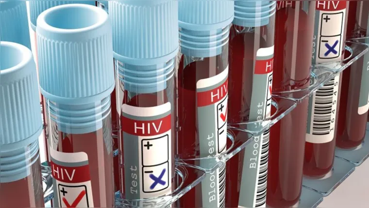 Imagem ilustrativa da notícia Mulher é terceira curada de HIV no mundo, dizem cientistas