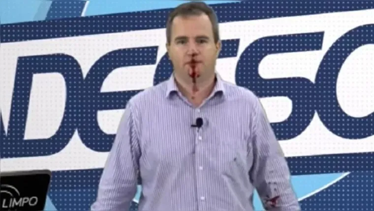 Imagem ilustrativa da notícia Vídeo: jornalista surge sangrando ao vivo após ser agredido