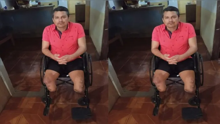 Imagem ilustrativa da notícia Professor pede ajuda para ter próteses e cadeira de rodas