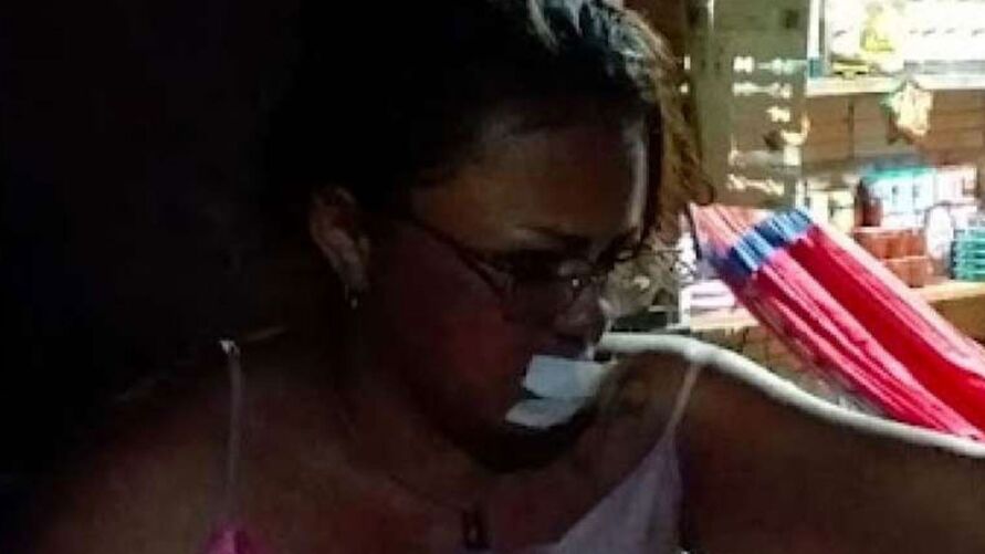 Mulher foi mordida na boca ao tentar separar casal em Itaituba