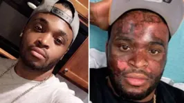 Neyo White quer processar o spa que realizou o procedimento