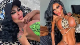 Tara Jayne McConachy tem 33 anos e já fez incontáveis aplicações de Botox