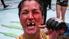 Logo após a luta, a lutadora postou uma foto sem os dentes da frente em suas redes sociais